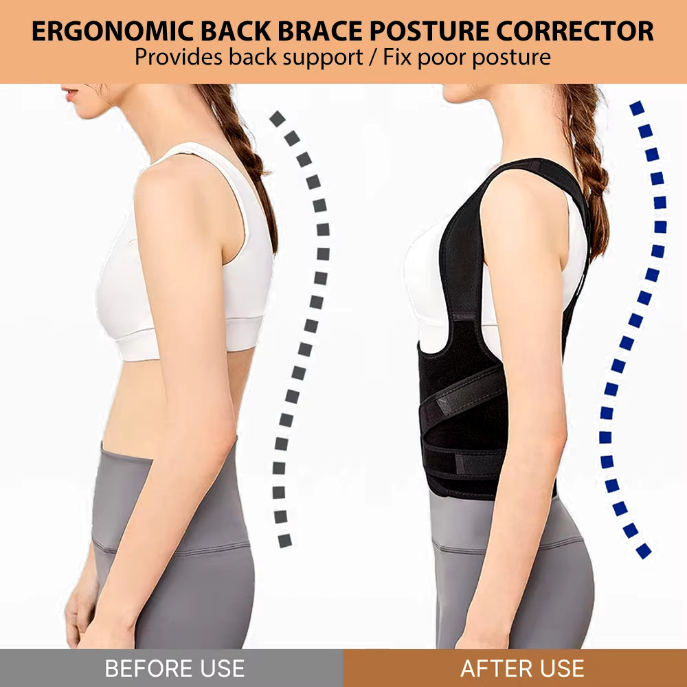 Back Brace and Posture Corrector for Men and Women, Back Straightener Posture Corrector Scoliosis & Hunchback Correction Support